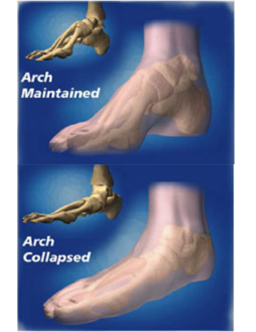 orthoticsarch