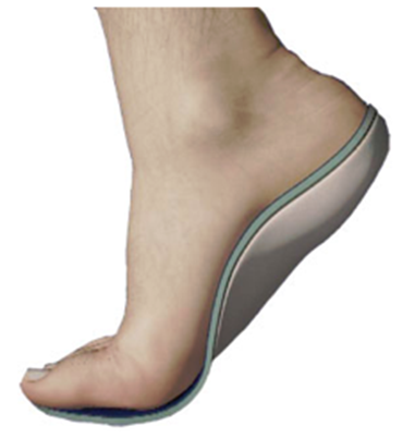 orthoticsflatfeet